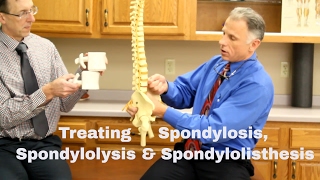 Treating Spondylosis Spondylolysis amp Spondylolisthesis Lumbar Spine [upl. by Awuhsoj]