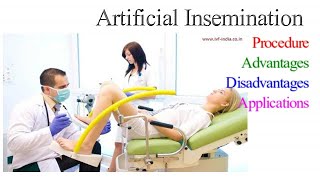 Artificial Insemination in humans I Procedure types Advantages Disadvantages and Applications [upl. by Hara]