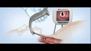 GlideScope Titanium Video Laryngoscopes Demonstration [upl. by Arreip]