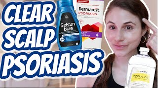 How to CLEAR SCALP PSORIASIS Dr Dray [upl. by Iralav]