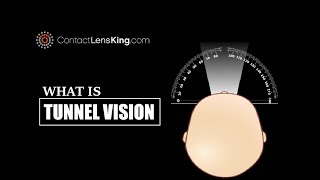 Whats Tunnel Vision Symptoms and Loss of Peripheral Vision [upl. by Alonso]