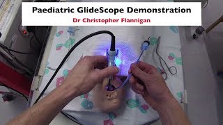 GlideScope Demonstration [upl. by Notnelc]