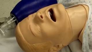 Tracheal intubation fiberopticassisted [upl. by Gney24]