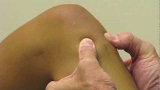 ACL Exam Lachmans Test Pivot Shift Drawer Test performed by Dr Eric Janssen [upl. by Enoval]